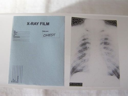 Röntgenbild Körper
